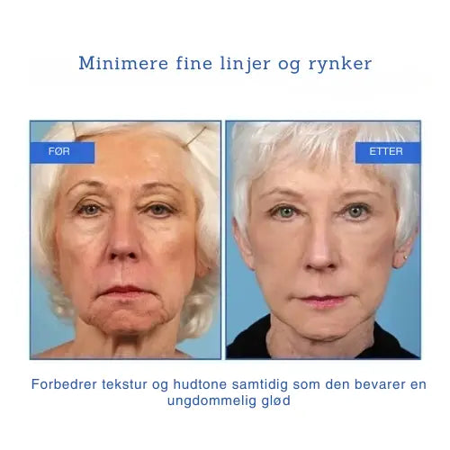 Botox Ansiktsserum Scandic Prestige