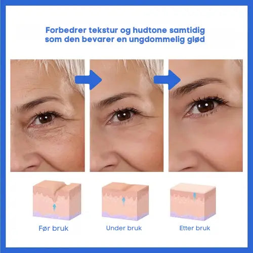 Botox Ansiktsserum Scandic Prestige